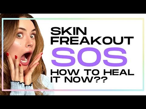 My Skin is Freaking Out | How to get rid of Acne, Blemishes and Spots 👩‍⚕️ | ALL YOU CAN FACE
