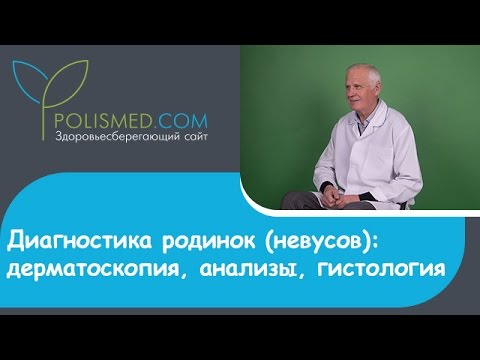 Диагностика родинок (невусов): дерматоскопия, анализы, гистология