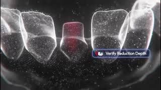 Enhance Scanning Efficiency with Realtime Intelligence