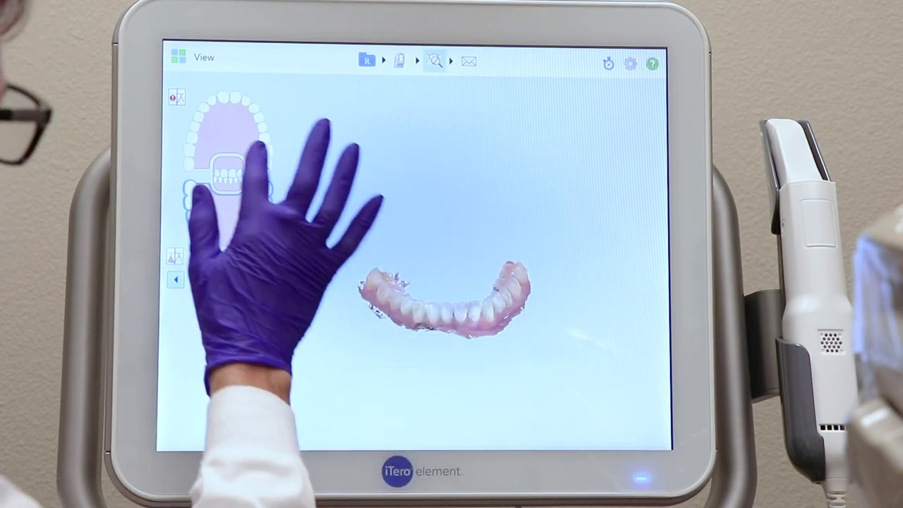 The Itero Machine | Dr. Meagan | South Meadows Dental & Orthodontics in Reno