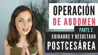 Operación Abdomen #POSTCESÁREA - ¿Ha sido bueno o malo? Cuidados primeras semanas - Parte 2