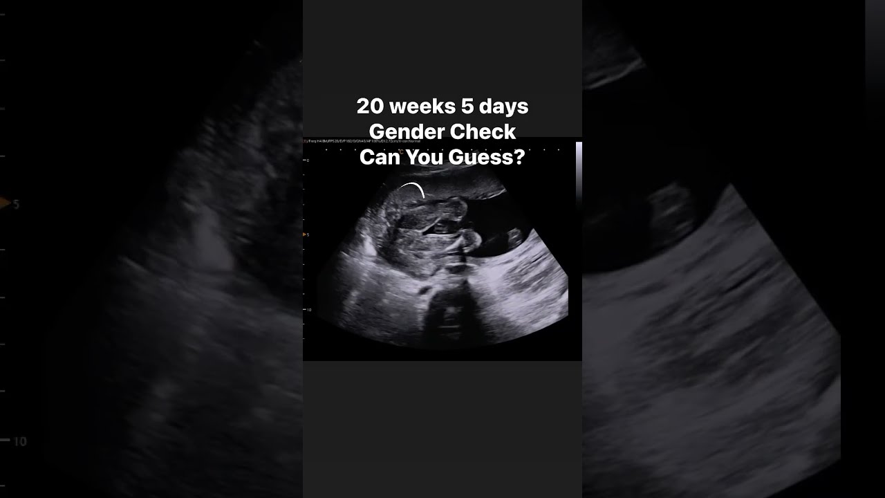 20 Weeks 5 Days Gender Check Jerbearimaging Genderreveal Girlorboy Boyorgirl Fyp