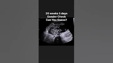 20 Weeks 5 Days Gender Check Jerbearimaging Genderreveal Girlorboy Boyorgirl Fyp 