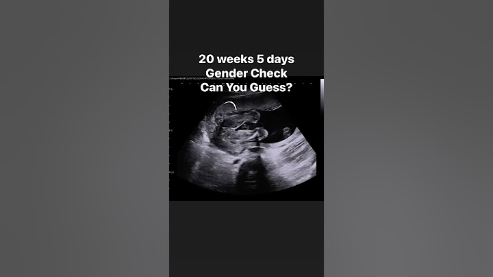 20 weeks 5 days Gender Check #jerbearimaging #genderreveal #girlorboy #boyorgirl #fyp