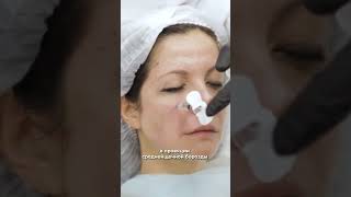 Коррекция среднещечной борозды