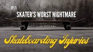 MY WORST SKATEBOARDING INJURY - A LONG ROAD TO RECOVERY