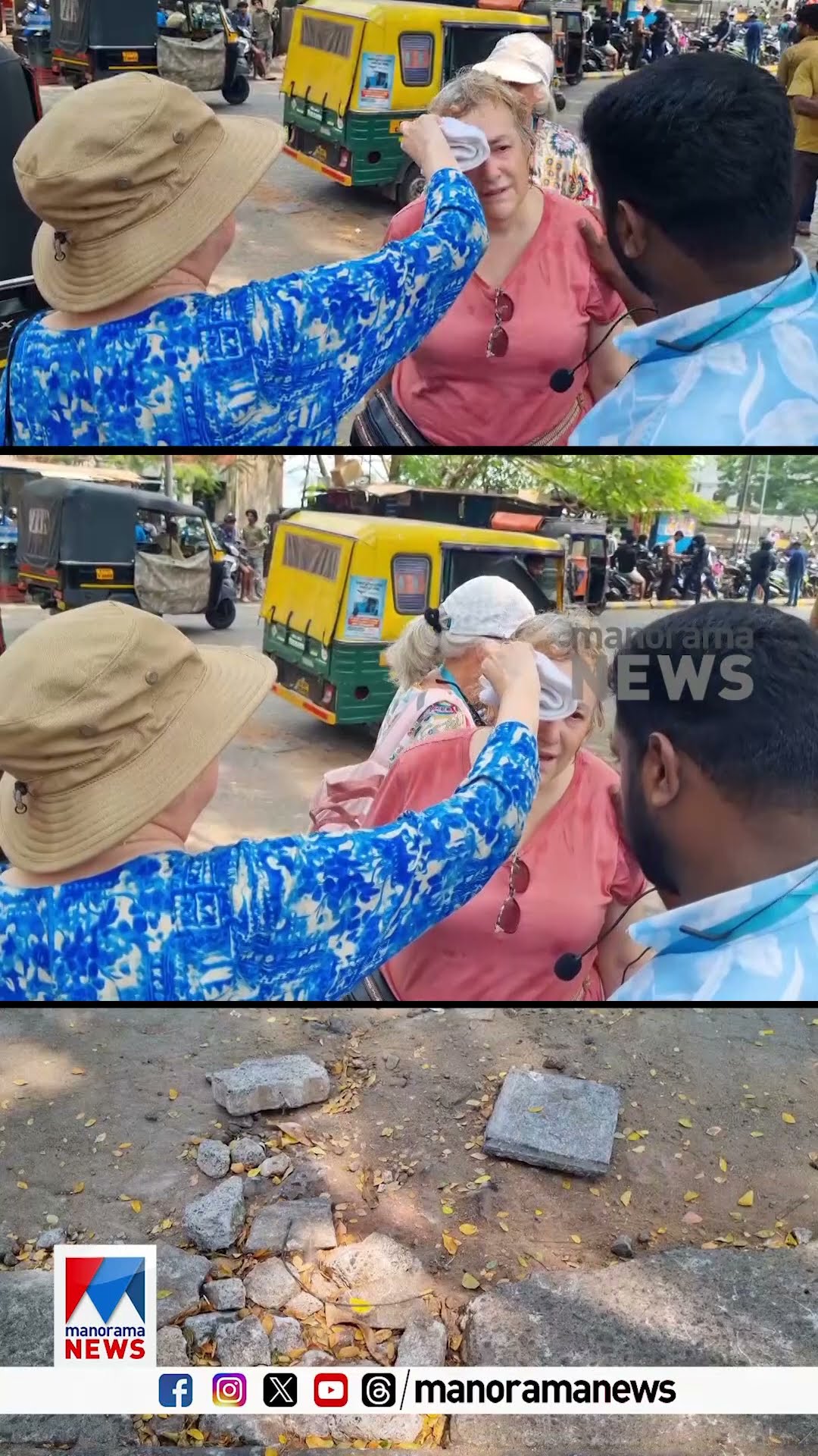 ഫോർട്ടുകൊച്ചിയില്‍ ഗട്ടറില്‍ വീണ് വിദേശ വനിതക്ക് പരിക്ക്  #FortKochi #Tourist