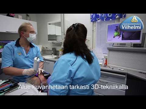 Video: Hygieniaprotokollat hammasproteesien Aiheuttaman Stomatiitin Hoidossa: Paikallisten Ja Systeemisten Parametrien Analyysi - Satunnaistettu, Kaksoissokkotutkimusprotokolla
