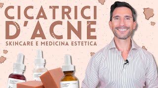 CICATRICI D’ACNE, SKINCARE E MEDICINA ESTETICA