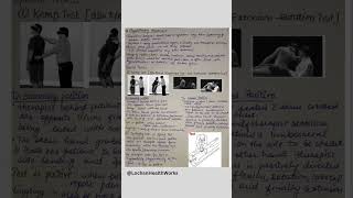 Facet Joint Syndrome #handwritten #physiotherapy #notes #bass #passobemsolto #shorts #shortvideo