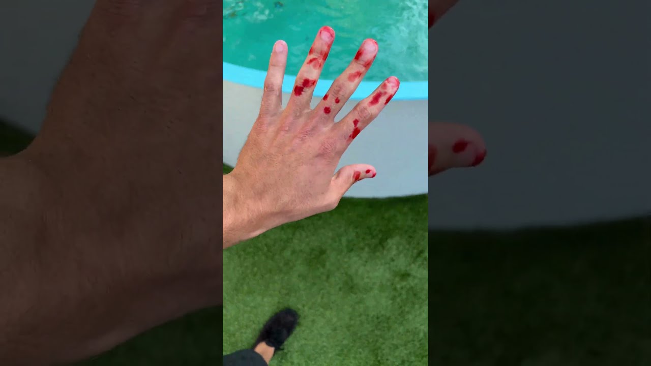 WHEN JAWS Attack You P 2