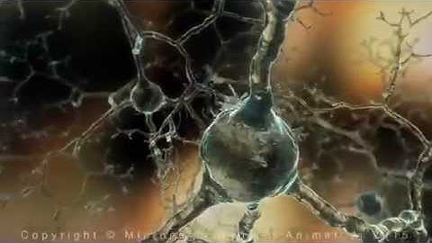 Alzheimer