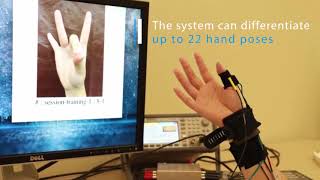 FingerPing: Recognizing Fine-grained Hand Poses using Active Acoustic On-body Sensing