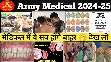Agniveer Army Medical Kaise Hota Hai | Agniveer Army Medical Test 2025 Kaise Check Hota Hai