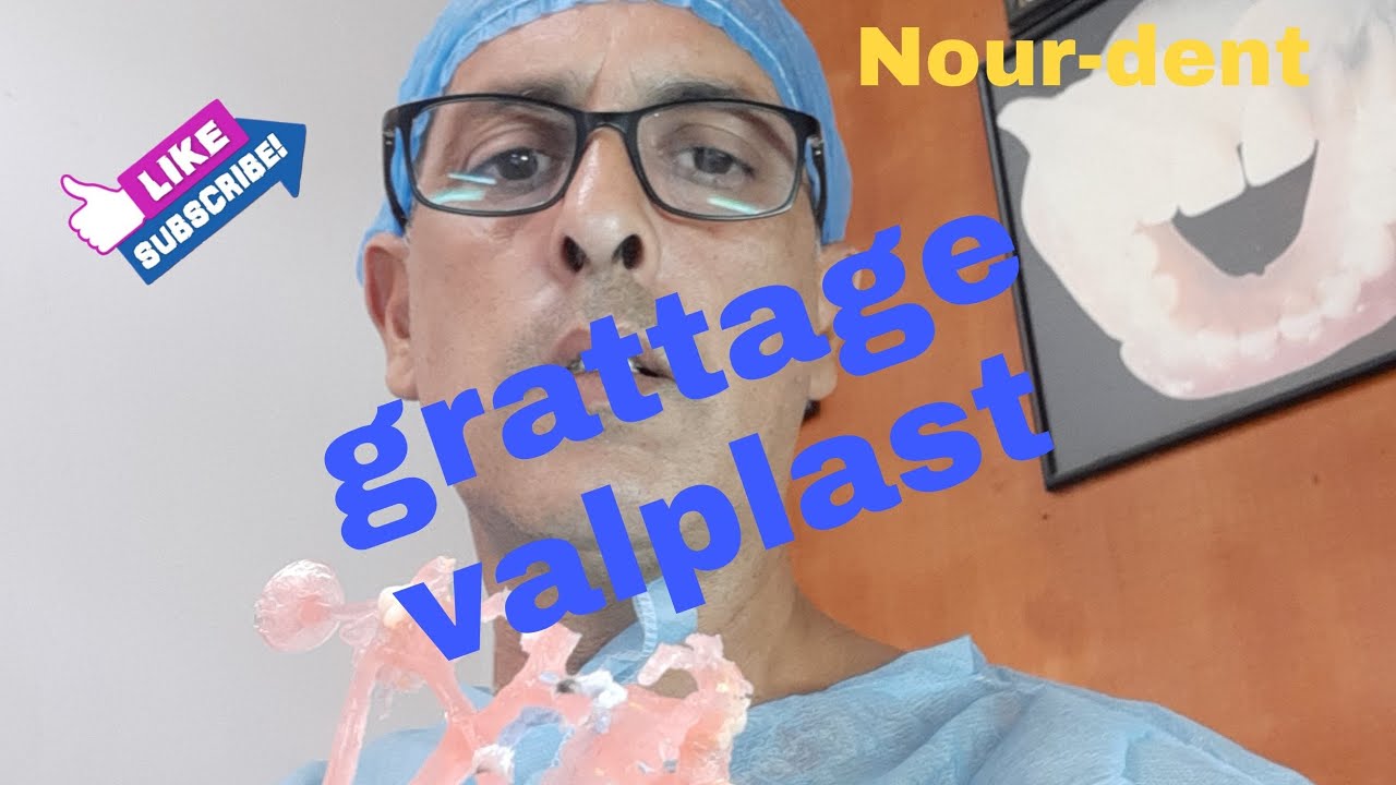 Grattage Valplast Prothèse dentaire