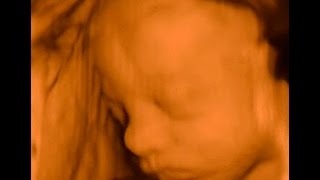 29 неделя беременности с фото и видео
