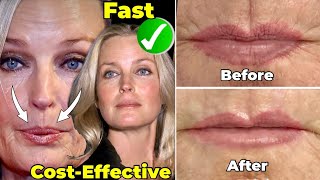 How to Get Rid of Wrinkles around your Mouth from Smoking and Prevent them from Happening