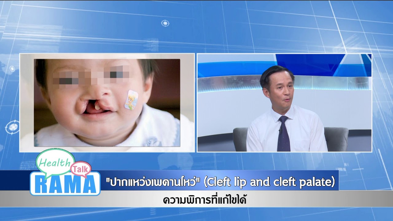 “ปากแหว่งเพดานโหว่”ความพิการที่แก้ไขได้ : พบหมอรามา ช่วง Rama Health Talk 3 ก.ค.61(2/5)