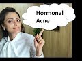 Hormonal Acne | Resistant Acne | Treatment | Dr. Aanchal Panth