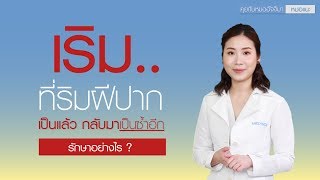 "เริมที่ริมฝีปาก เป็นแล้วกลับมาเป็นซ้ำอีก รักษาอย่างไร" : หมอแนะ รายการคุยกับหมออัจจิมา