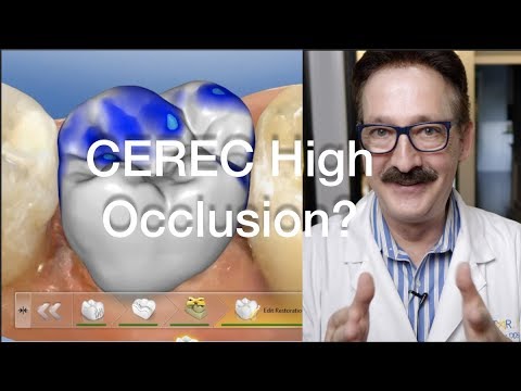 High Occlusion in CEREC!