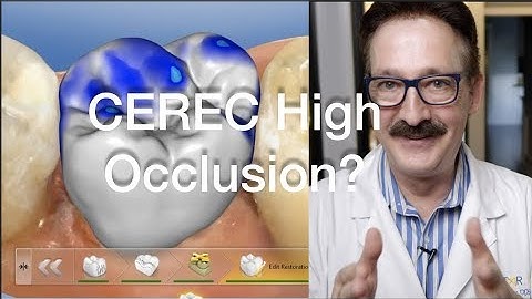 High Occlusion in CEREC!
