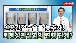 인공관절수술은 최대한 늦추자!