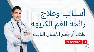 أسباب وعلاج رائحة الفم الكريهة بعد عمل غلاف أو جسر الأسنان الثابت