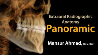 Panoramic Radiographic Anatomy screenshot 5