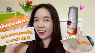 🧡ทดลองใช้เจลรักษารอยแผลเป็น BeBetter กับแผลเป็นที่นานกว่า 20 ปี✨ | [ดิฉันขอบอกว่า💁🏻‍♀️]