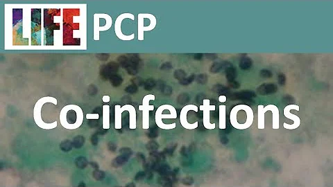 Pneumocystis coinfections