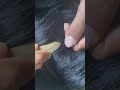 #fypviralシ #statisfying #lice #hair #LiceOnHead #liceremoval #brasil #xyzbcafyp #licecomb #kutu