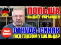 ПОЛЬША ВЫДАЕТ УКРАИНЦЕВ / ОТКУДА СИНЯК ПОД ГЛАЗОМ У ШОЛЬЦА?