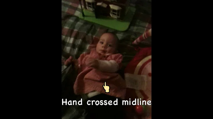 AIMS Evaluation 3 to 6 Months Education and Practice Case 7 Supine Lying