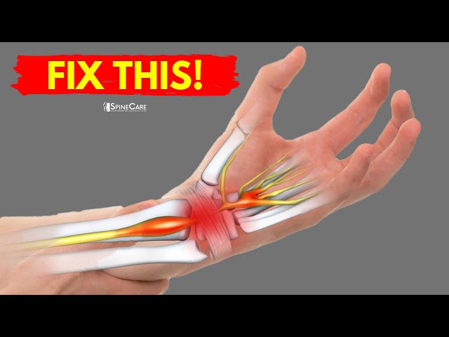 Ultimate Wrist Pain Relief  Wrist pain relief, Wrist pain, Pain relief  remedies