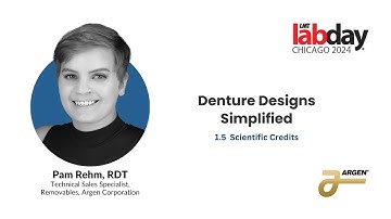 Denture Design Simplified