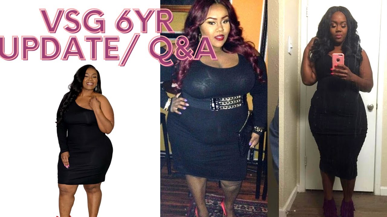 VSG Q&A: maintaining weight. pregnancy, plastic surgery