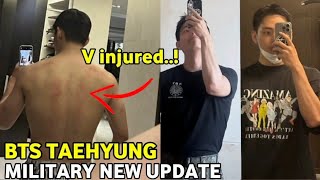 Bts Taehyung Injured During Training V Shared His 'Sdt' Military Unit Updates 2024