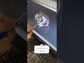 کیست کلیه بزرگ درسی تی اسکن دکتر سعید صادق زاده جراح و متخصص کلیه ومجاری ادراری تناسلی پروستات