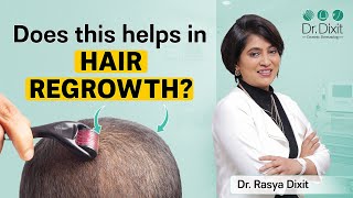 Derma roller For Hair Growth | Best Dermatologist In Bangalore | Dr. Rasya Dixit