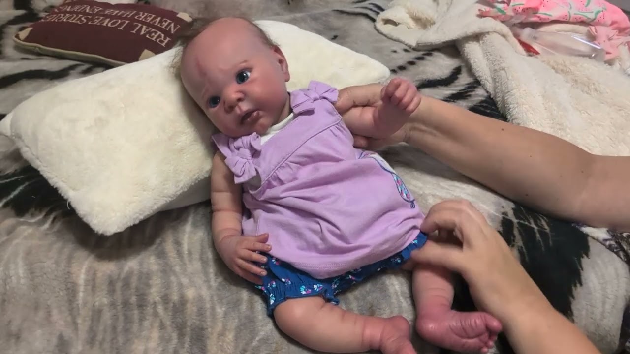 Scleroderma awareness month