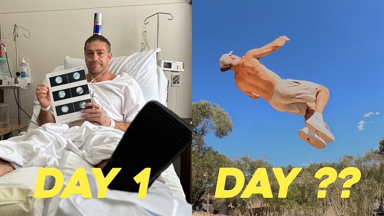 How soon can I BACKFLIP after surgery?!