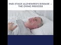 Uncovering the Reality of End-Stage Alzheimer's: How the Dying Process Unfolds 😶🌫