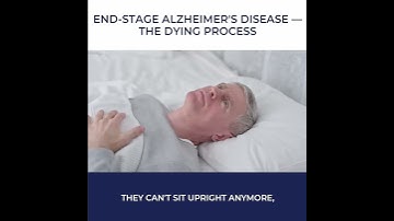 Uncovering the Reality of End-Stage Alzheimer