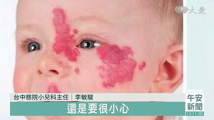 台中慈院｜婴儿草莓血管瘤 5岁以后多数消退 - 天天要闻