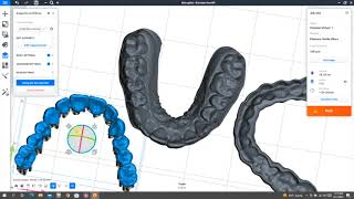 How to Support your Prints (for Einstein users)