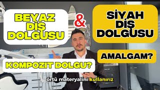 Beyaz Diş Dolgusu? Siyah Diş Dolgusu? Ağzımdaki Siyah Dolguları Değiştirmeli Miyim?