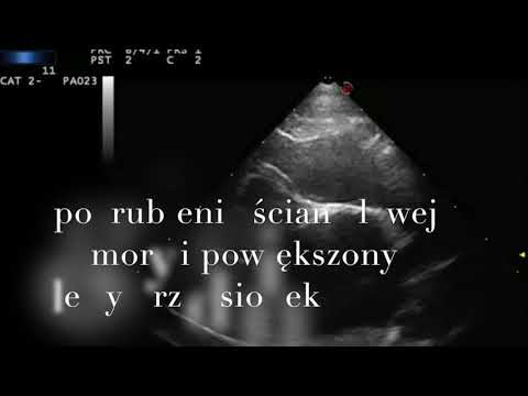 Wideo: Kardiomiopatia Przerostowa (HCM) U Kotów - Choroba Serca U Kotów