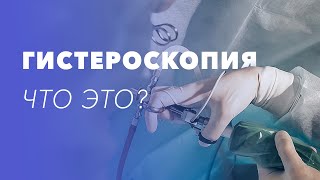 Гистероскопия - что это? Гистероскопия матки: как делают, при каких заболеваниях, особенности метода