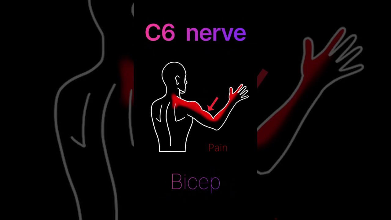 Pinched Nerve In The Neck Shorts